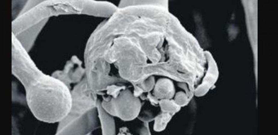 covid black fungus rising cases